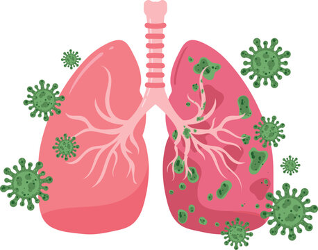 Lungs Infected with Virus Medical Illustration
