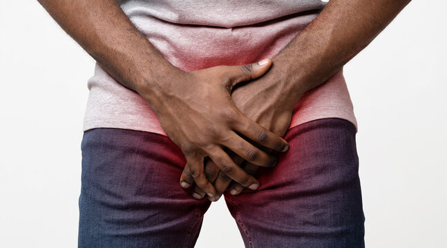 Afro man covering his genitals with both hands, cropped, sexual diseases concept