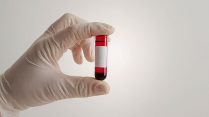 Blood sample held by medical professional wearing sterile glove in lab, perfect for health, research, and medical content, showcasing care and precision