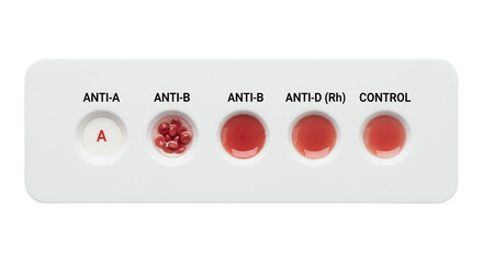 Blood Typing Test Card Agglutination Reaction Medical Diagnosis