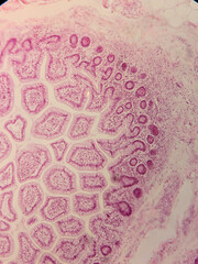 Human Jejunum with Villi and Crypt