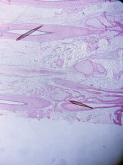 Histology of Human Scalp Tissue