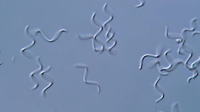 Spirochetes bacteria under microscopy 