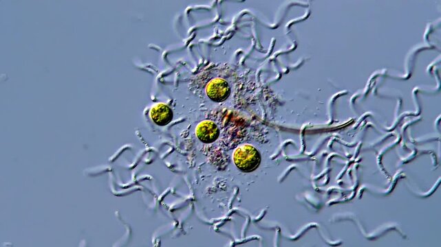 Algae and spirochetes bacteria under microscope 