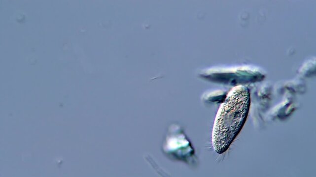 Ciliophora protozoa under microscopy, pond water sample 