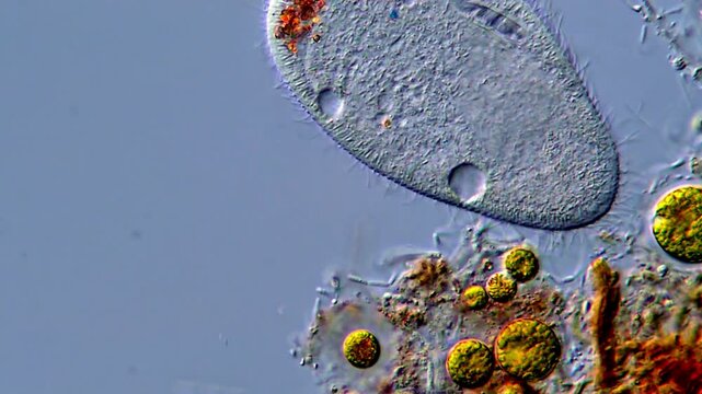 Microorganism under DIC microscope, Paramecium ciliophora 