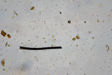 australian regenerative agriculture soil microorganisms and soil biology, with nematodes and fungi under the microscope. in a soil and compost sample