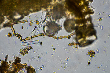 australian regenerative agriculture soil microorganisms and soil biology, with nematodes and fungi under the microscope. in a soil and compost sample