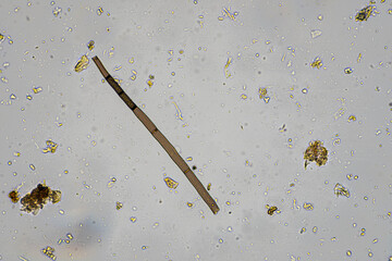 australian regenerative agriculture soil microorganisms and soil biology, with nematodes and fungi under the microscope. in a soil and compost sample