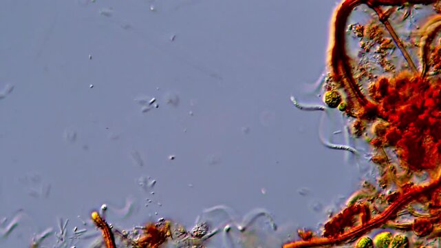 Bacteria under microscopy view, spirochetes bacteria 