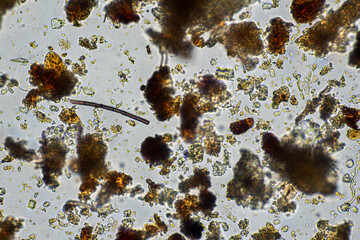 bugs in living soil microbes organisms in a soil and compost sample, fungus and fungi and under the microscope in regenerative agriculture. in australia.