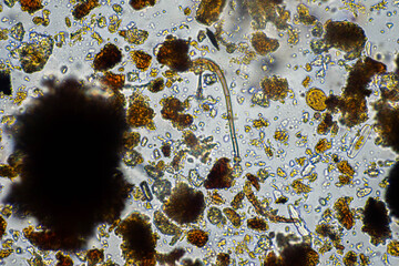 bugs in living soil microbes organisms in a soil and compost sample, fungus and fungi and under the microscope in regenerative agriculture. in australia.