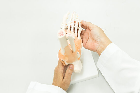 Orthopedist explain to the patient for human foot bone injury treatment program.Doctor showing to feet fingle bone anatomy and ligaments pain.Physiotherapy present foot model for injured athlete. - Powered by Adobe