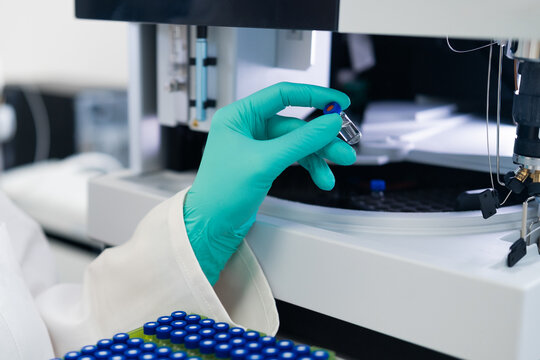 Close up woman scientist in rubber gloves puts the vial to HPLC system with auto sampler. Chemical and clinical analysis
