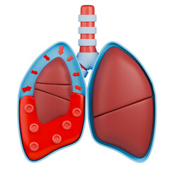 3D medical illustration of hemothorax. Blood and red blood cells accumulate in the pleural space, causing the lung to collapse. Red arrows indicate the immense pressure exerted on the lung.