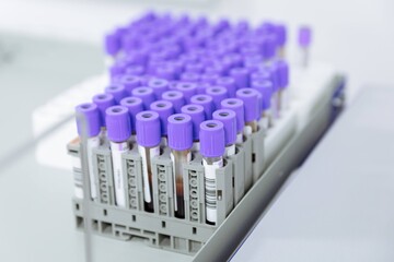 Science, blood test and hands of person with sample for biotech engineering, pathology and hematology research. Laboratory, exam and scientist with glucose analysis, development or medical study. High