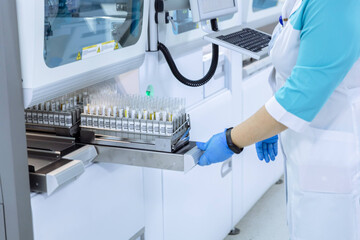 Science, blood test and hands of person with sample for biotech engineering, pathology and hematology research. Laboratory, exam and scientist with glucose analysis, development or medical study. High