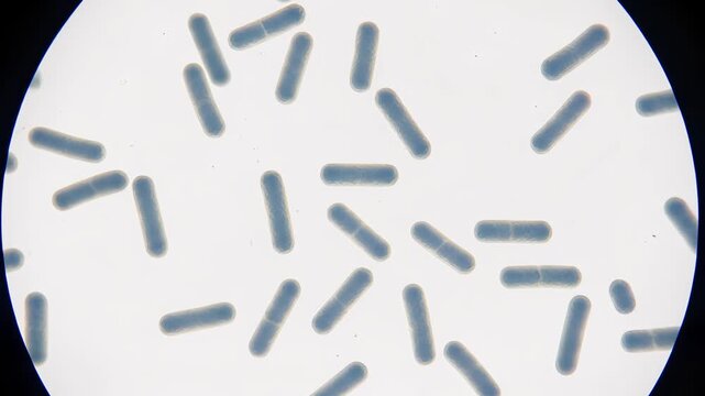 Close Up View of Bacteria Under Microscope in Laboratory Setting