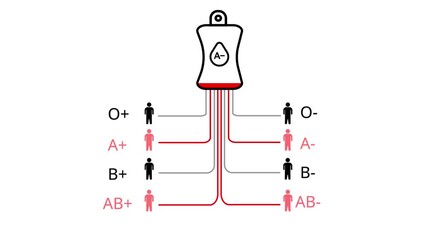 Blood type compatibility chart with A negative blood bag and compatible recipient icons Keywords: blood type, compatibility, chart, diagram, medical, healthcare, science, donation, transfusion, A