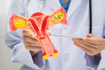 Uterus, doctor holding human anatomy model for study diagnosis and treatment in hospital.