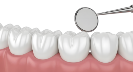 Close up of healthy white teeth examined by a dental mirror showing good oral hygiene.