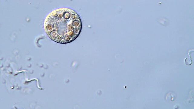 Vibrant 4K Ultra HD Microscopy of Protozoa Ciliates