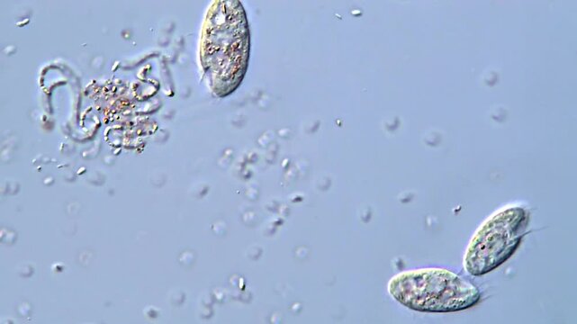 High Definition 4K Ultra HD Footage of Ciliate Protozoa