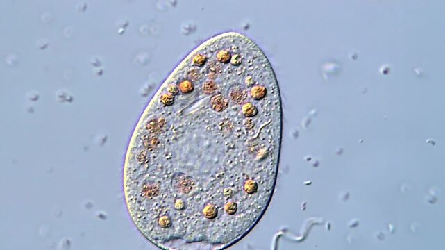 Protozoa under microscope, Ciliate protozoan 