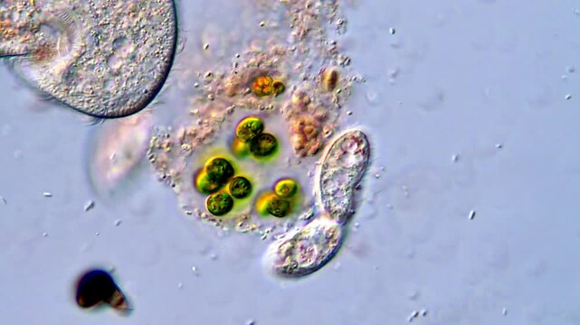 Microorganism under microscopy, 400x magnification 