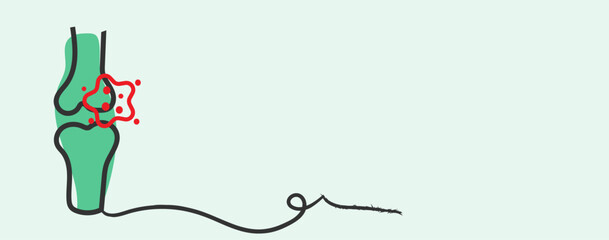 Pinpointing Inflammation A Stylized Glimpse into Joint Pathophysiology and Precision Orthopedic Mapping