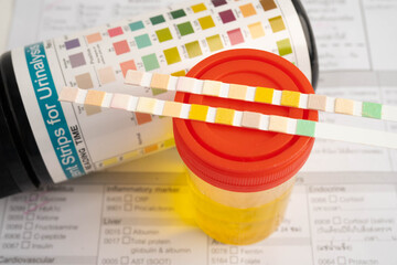 Urinalysis, urine cup with reagent strip pH paper test and comparison chart in laboratory.
