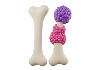Healthy Bone vs. Bone with Abnormal Cellular Growth - Medical Illustration of Disease Concept