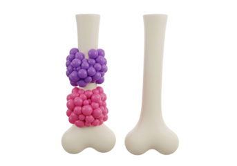 Bone Health & Cellular Dynamics: 3D Illustration of Bone Structure with Active Cells Compared to a Healthy Bone, Medical Biology Concept