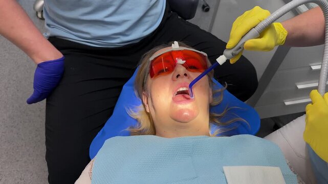 Dental equipment, dentist visit. At a dental clinic, a patient wearing protective glasses undergoes a teeth whitening procedure using a blue light device. Dental care, healthcare, medicine, clinic
