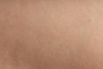 Human skin, closeup view. Detailed texture of surface