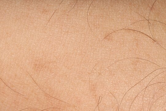 Macro view of human skin with birthmarks as background