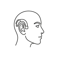 Cochlear implant illustration displays modern hearing aid device on human head, ear model. Hearing aid implantation improves hearing ability and sound perception.