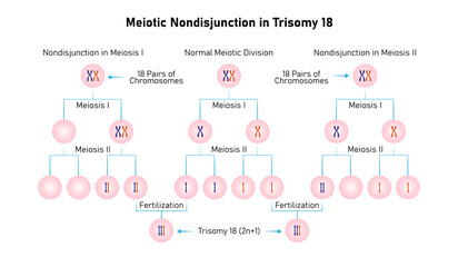 Meiotic Nondisjunction in Trisomy 18 Science Design. Vector Illustration.