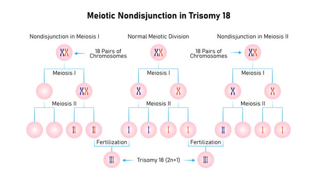 Meiotic Nondisjunction in Trisomy 18 Science Design. Vector Illustration.