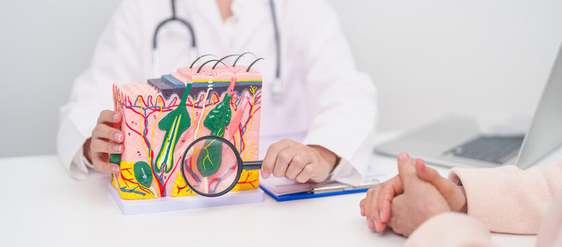 woman Patient consultation Dermatologist with anatomy of skin and hair. Skin disease and Hair loss, Systemic Lupus Erythematosus or SLE, world lupus day, May Melanoma and Skin Cancer Awareness month