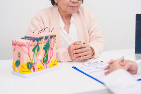 woman Patient consultation Dermatologist with anatomy of skin and hair. Skin disease and Hair loss, Systemic Lupus Erythematosus or SLE, world lupus day, May Melanoma and Skin Cancer Awareness month