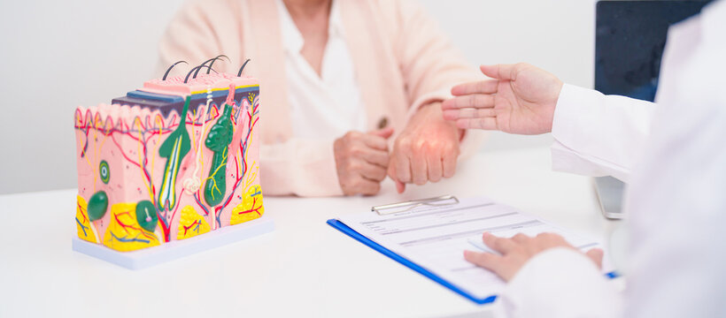 woman Patient consultation Dermatologist with anatomy of skin and hair. Skin disease and Hair loss, Systemic Lupus Erythematosus or SLE, world lupus day, May Melanoma and Skin Cancer Awareness month