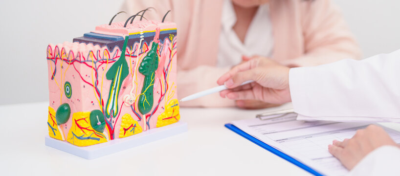 woman Patient consultation Dermatologist with anatomy of skin and hair. Skin disease and Hair loss, Systemic Lupus Erythematosus or SLE, world lupus day, May Melanoma and Skin Cancer Awareness month