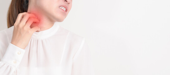 Business woman itching Neck and body scratching for Skin Allergy from insect bite and food dermatitis. Dermatology, Leprosy day, Systemic lupus erythematosus, Psoriasis, Urticaria and rash Eczema