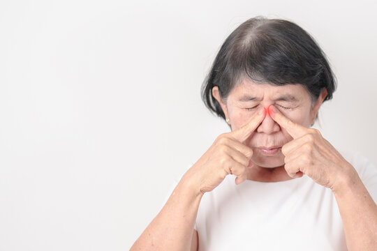Elderly Woman having Nose pain for concepts of Nose disease, Common Cold, Influenza, Flu, Covid 19, Respiratory Infection, Sinusitis, Allergic Rhinitis, Asthma, Allergy, Dry nose Anosmia and Health