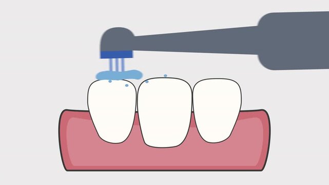 Brushing teeth with an electric toothbrush