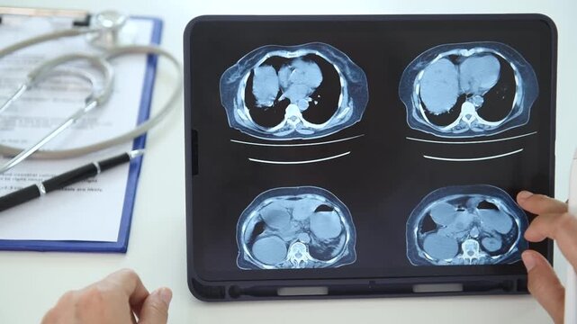 doctor radiologic diagnose abdomen x-ray image and abdominal scan  show liver, colon,spleen, small intestine, bladder on digital tablet.