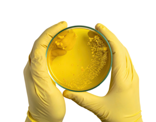 Gloved hands holding a petri dish filled with yellow agar and bacterial colonies