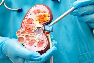 Kidney disease, Chronic kidney disease ckd, Doctor hold model to study and treat in hospital.