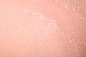 Fototapeta premium Macro view of dry human skin with wrinkles as background